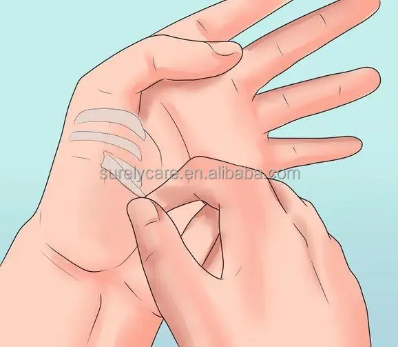 
Surelycare Breathable design Adhesive Skin Closures 