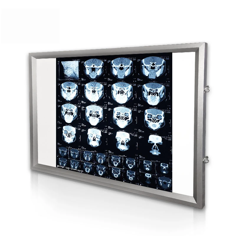 wholesale medical hospital blue x-ray film viewer with high quality