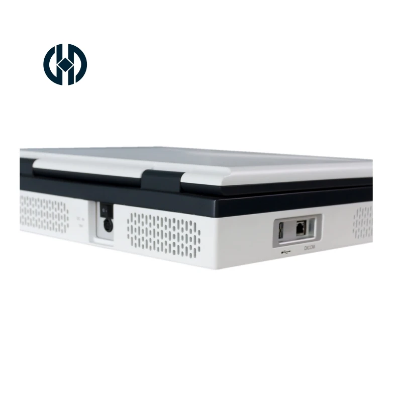 15 inch diagnostic ultrasound scanner ultrasound machine portable for ob echocardiogram musculoskeletal human medical