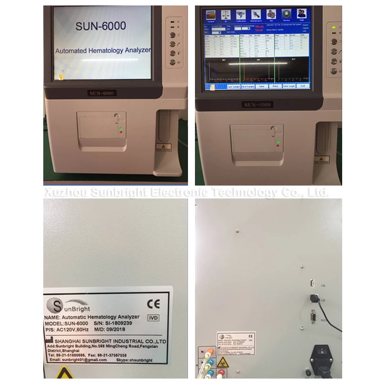 Hematology Analyzer Widely Used Superior Quality Hematology Analyzer hematology machine