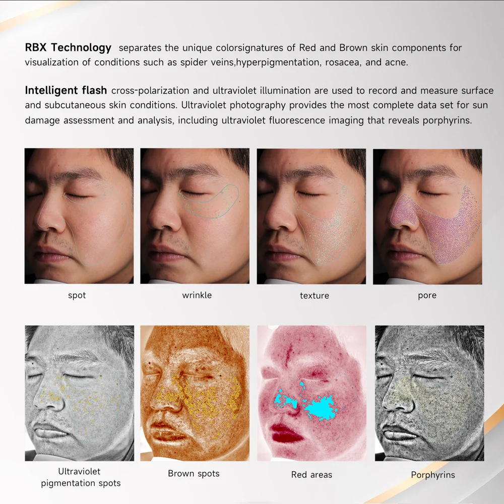 3D AI Dermatoscope Facial Skin Analyzer UV Light Smart Face Scanner for Spa Beauty Salon