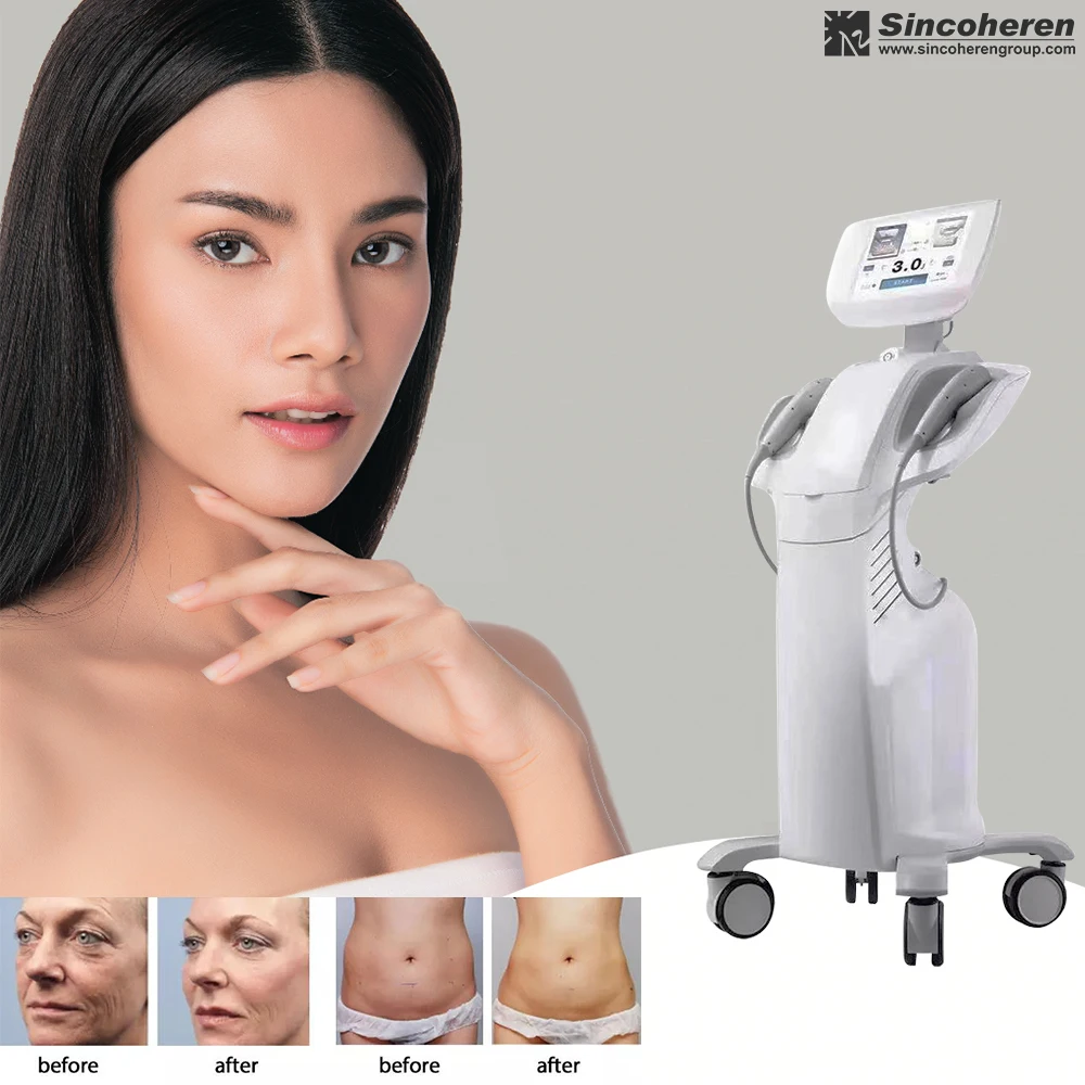 former 3 7d hifu smas face lifting Anti-wrinkle Korea face lifting Machine with 7 cartridge  III