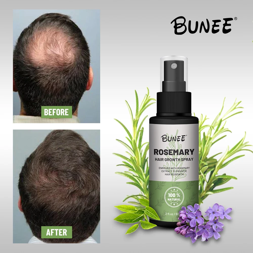 Private Label 120ml Natural Deep Hydrating Rice Water Rosemary Extract Hair Spray for Hair Growth with Biotin