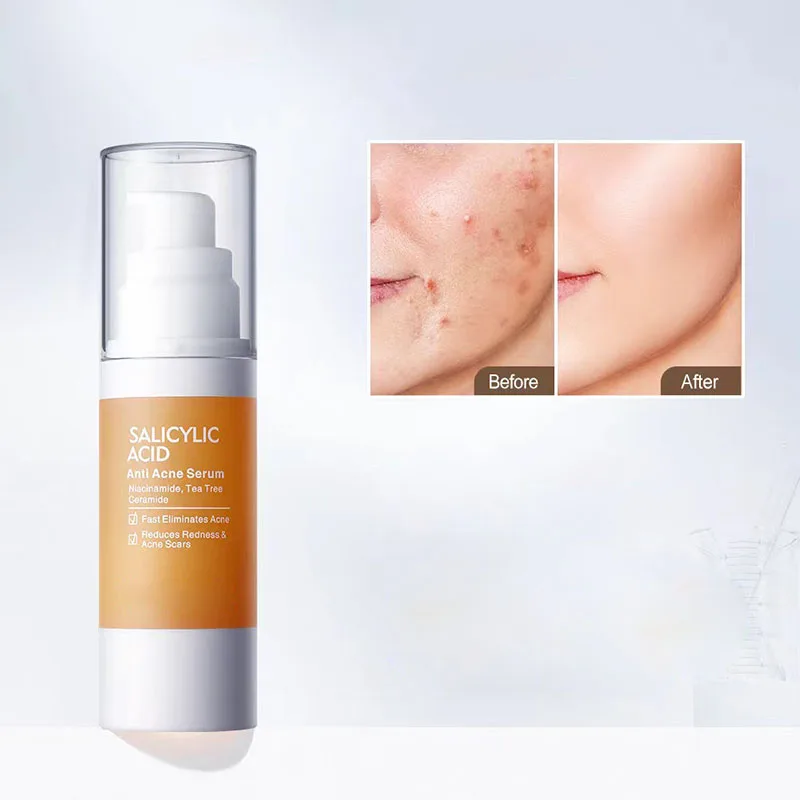 Organic Fast-Acting  Salicylic Acid Liquid Face Serum Hydrating Scar Niacinamide with Retinol and Turmeric for Aging Skin