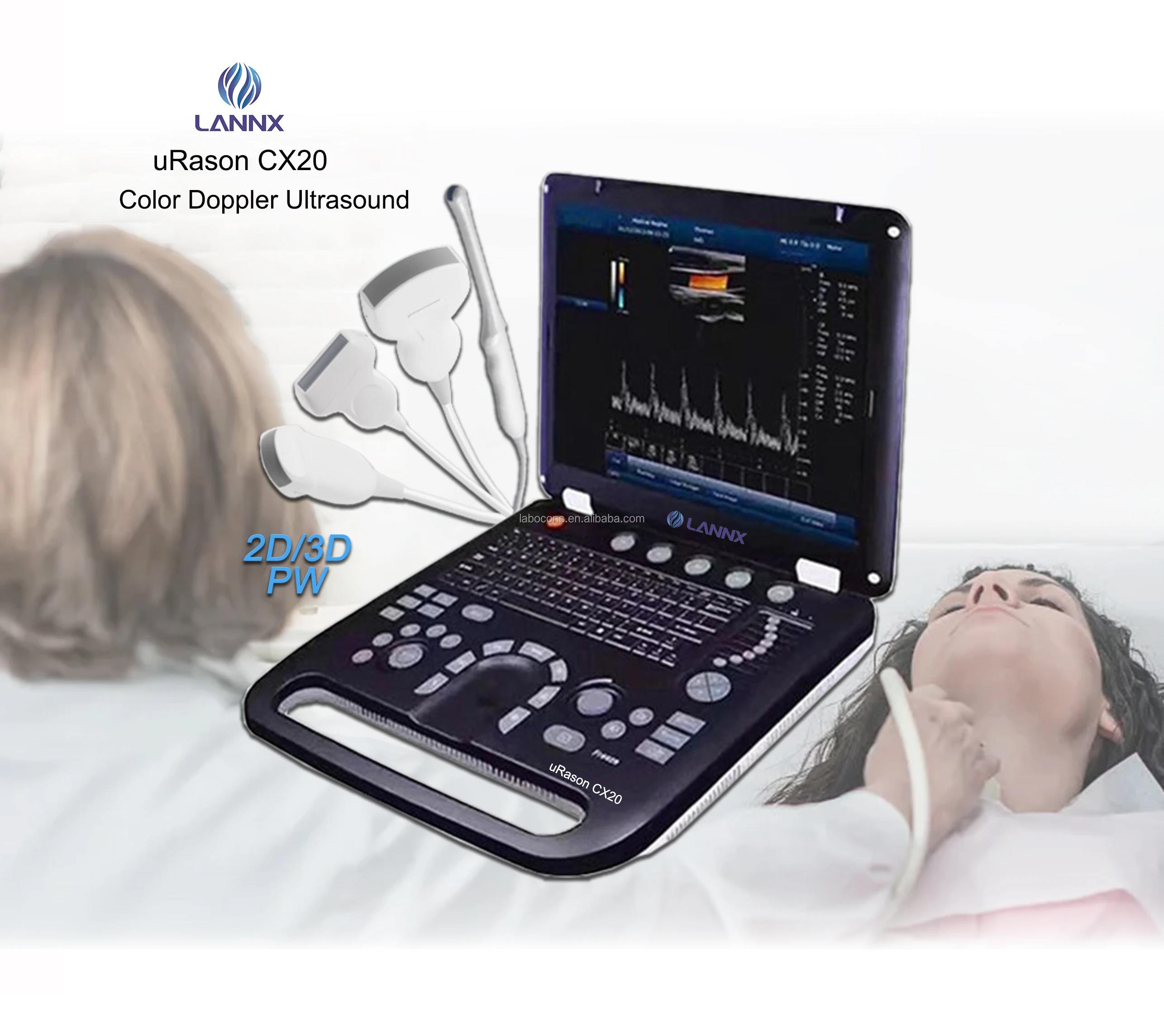 LANNX uRason CX20 Portable medical ultrasound instruments Color Doppler Ultrasound Scanner 2D/3D optional ultrasonido doppler