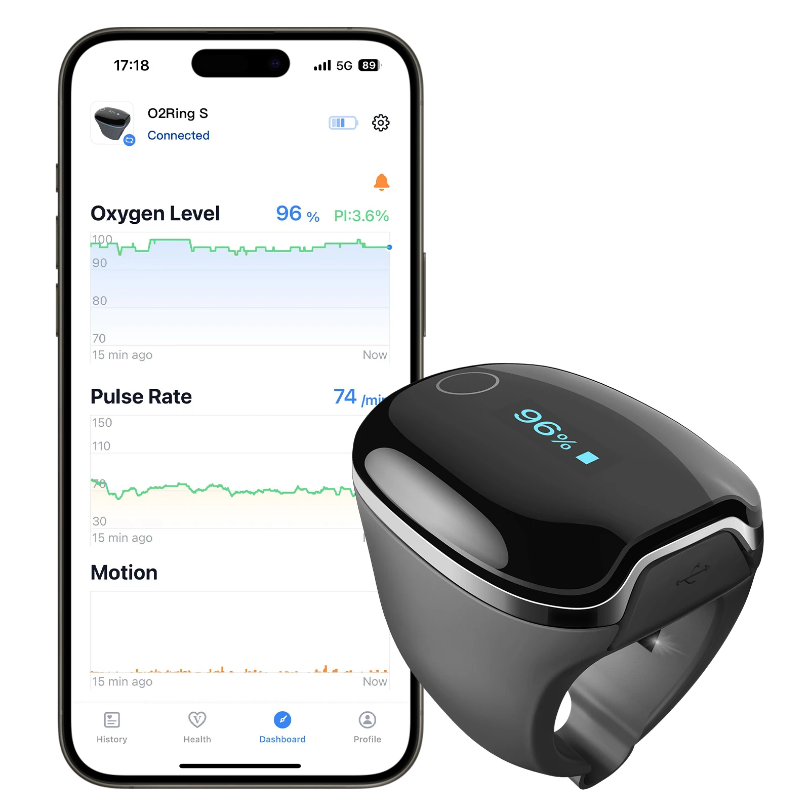 Wellue O2ringS SPO2 Blood Oxygen Saturation 4*10 Hours Built-in Memory for COPD and CPAP Pulse Oximeter Connects Via Bluetooth