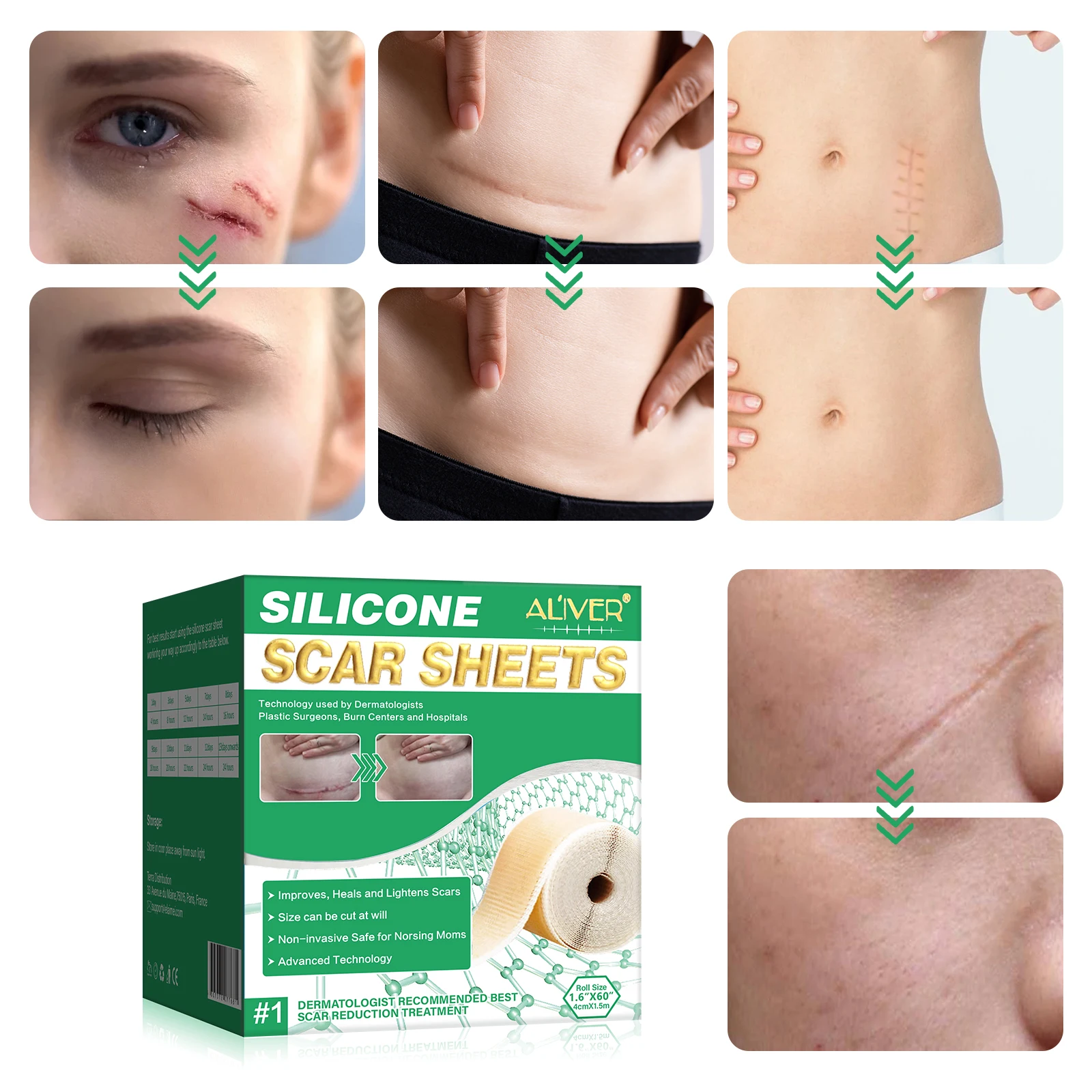 ALIVER Scar Cover Sheets Tape Advanced Silicone Scar Sheet for Face Body Breast Legs Arms Scar Repair