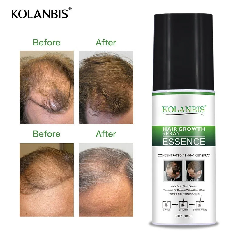 Wholesale Hair Growth Oil Bulk Sale The Best For Hair Growth Oil