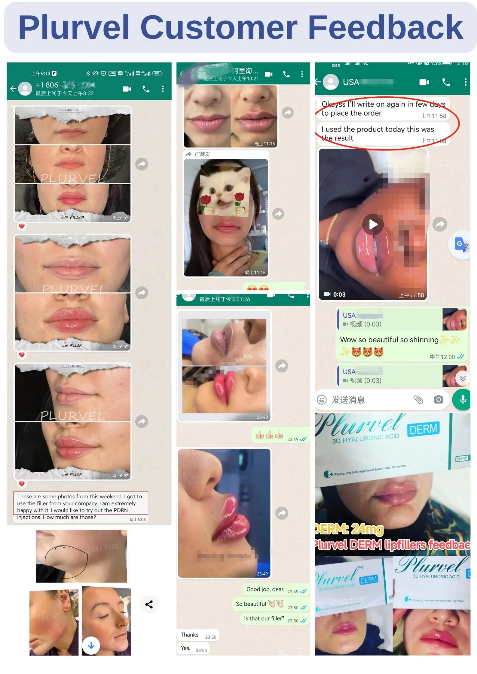 Plurvel Hyaluronic Acid 2ml 24mg/ml Pure Lips Dermal Filler Derm Injection With Needle And Lido For Lip