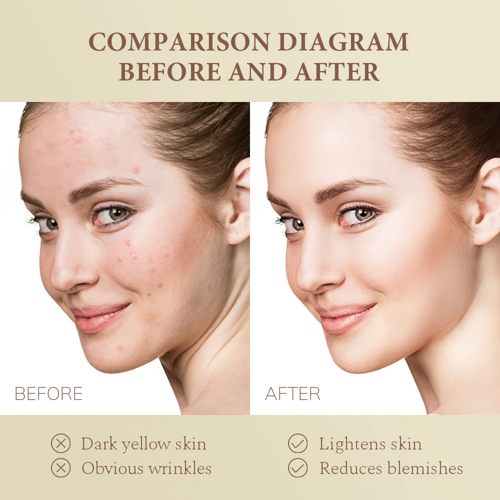 Wholesale Private Label Face Whitening and Eliminating Pigmentation Bearberry Extract arbutin Kojic Acid Cream