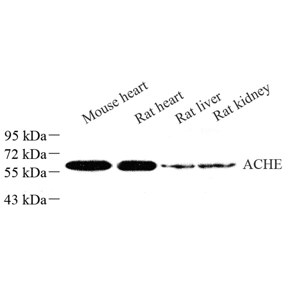 Anti -Acetylcholinesterase Rabbit Polyclonal Antibody