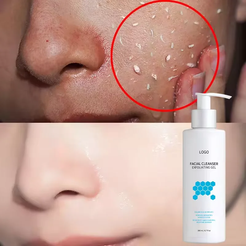 Private Label Organic Exfoliator Remove Dead Exfoliating Peeling Skin Gel Body Scrub Face Wash Facial Cleanser