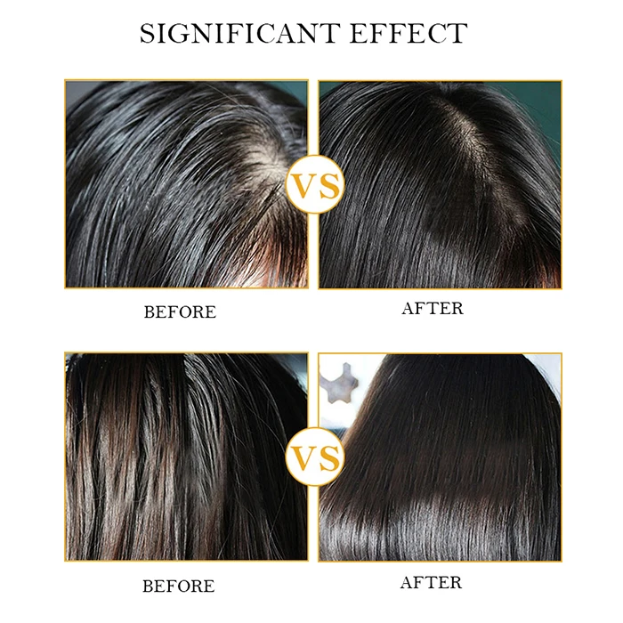 OEM Private Label Anti Itching  Anti Hair Loss  Natural Turmeric Shampoo Hair Care