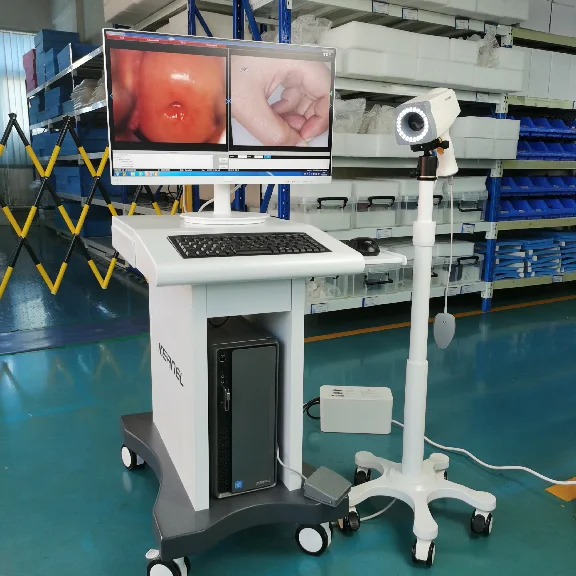 18x Optic Magnification Optical Medical Instrument Gynecology equipment Trolley type Colposcopy Vagina digital colposcope