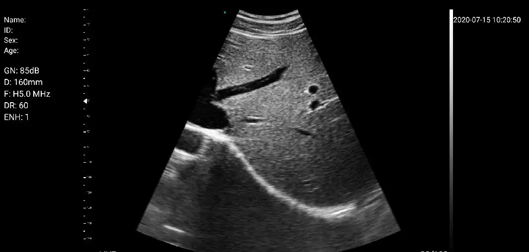 
2020 Wifi & USB handheld 3 in 1 ultrasound probe wireless price C10RL 