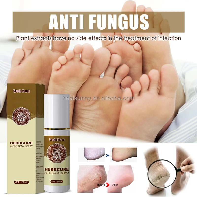 Foot Peeling Spray Natural Herb Essence Pedicure Prevent Odor deodorizing foot spray