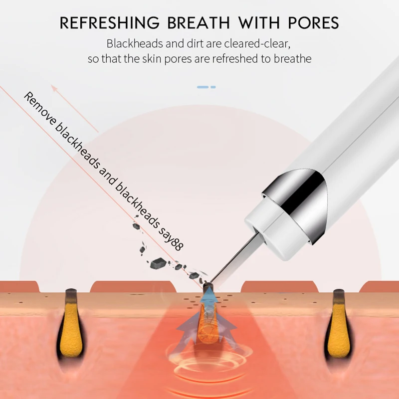 Most Sold Portable Peeling Ultrasonic Facial Pore Cleaning Skin Scrubber Machine