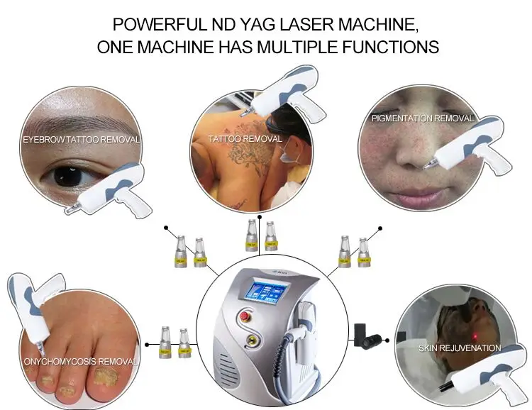  Медицинская CE 1064nm 532nm q переключаемая nd yag лазерная машина для удаления татуировок и
