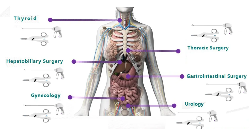Cheap Price Surgical Unit Bipolar Ligasure Same As Maryland Generator Ligasure LS10 Vessel Sealing Ligasure For General Surgery