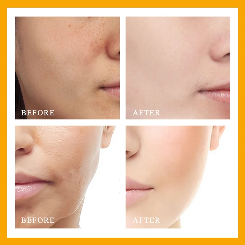 Уход за кожей лица 30 мл Niacinamide VC Сыворотка для увлажняющая Очищающая Восстанавливающая витамин