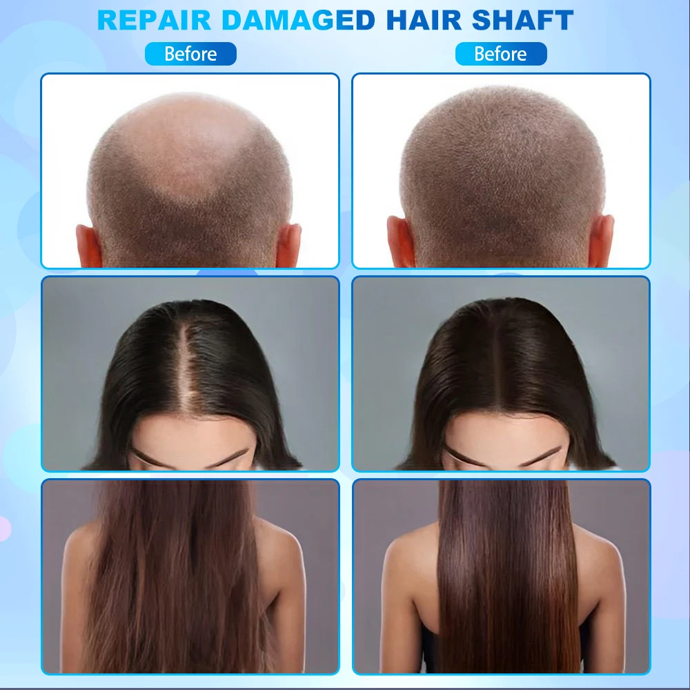 Scalp Care Electric Massage Comb For Hair Growth Hair Analyzer High Frequench Therapy Scalp Massager Hair Growth Machine