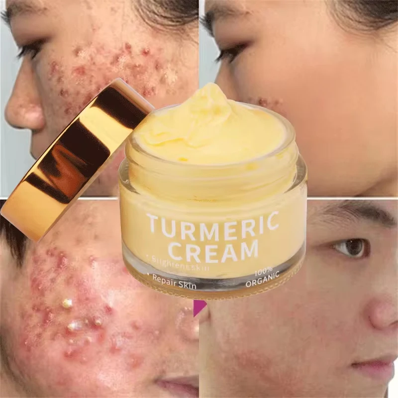 Private Label Organic Skin Care Whitening Moisturizer Acne Black Spot Vitamin c Turmeric Face Cream