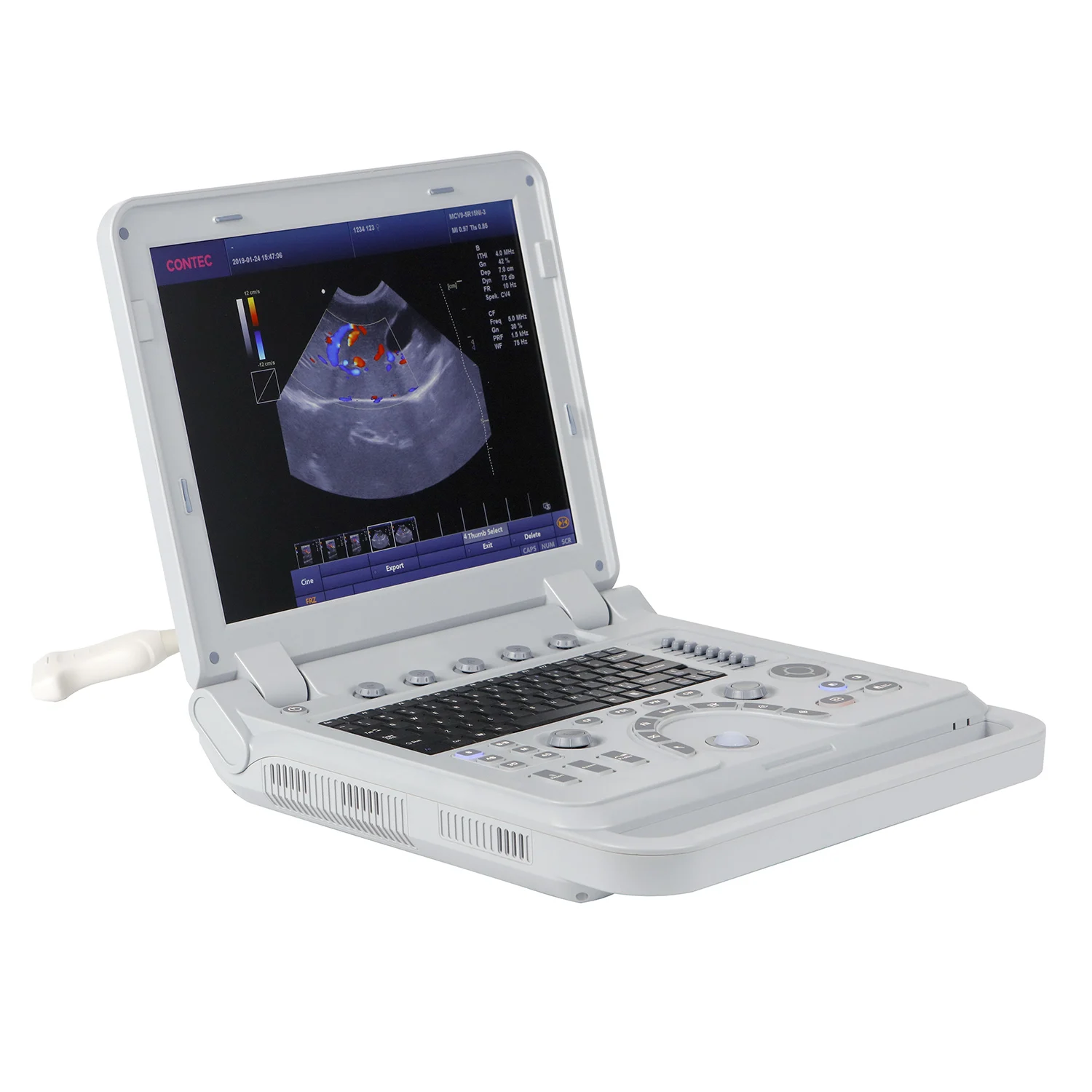 CONTEC CMS1700A colour doppler ultrasound scanner 3in 1 wifi  portable ultrasound table