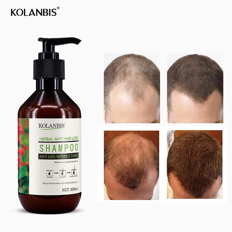 300ml Organic Growth Faster Stop Hair Loss Cosmetics Cure baldness shampoo