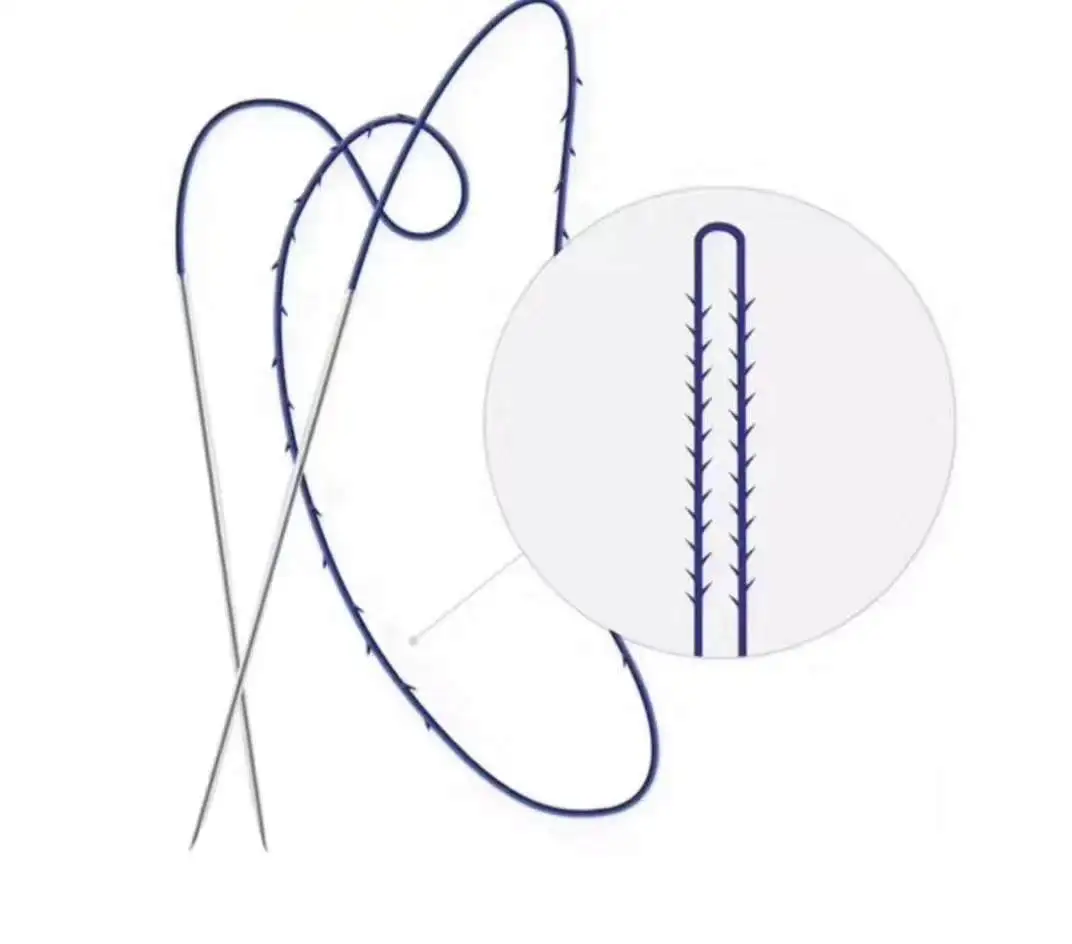 
High Quality Tissue Tension and Lift PDO Face Thread fishbone 20G 380mm double needle 