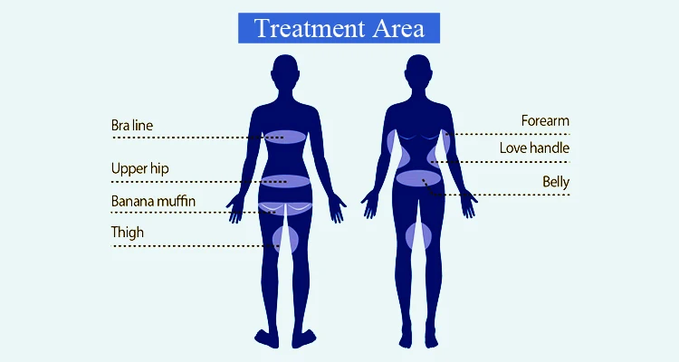 20% off sincoheren 2021 the most advanced technology of fat freezing machine crolipolysis