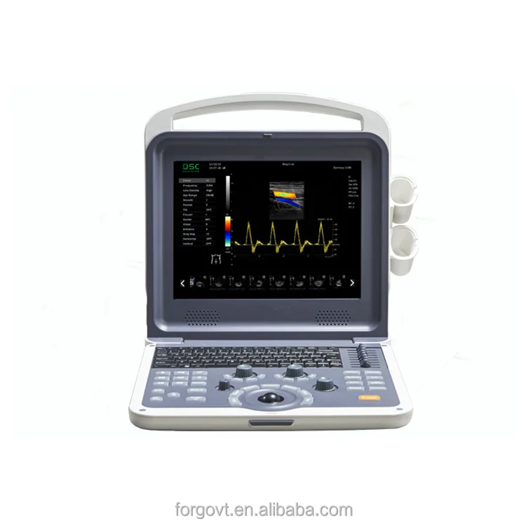 DSC Apogee 3300 цифровой 4D Цветной Допплер, ультразвуковой допплер, Цветной Допплер Sonoscapeecografo Eslastrografia Doppler Color