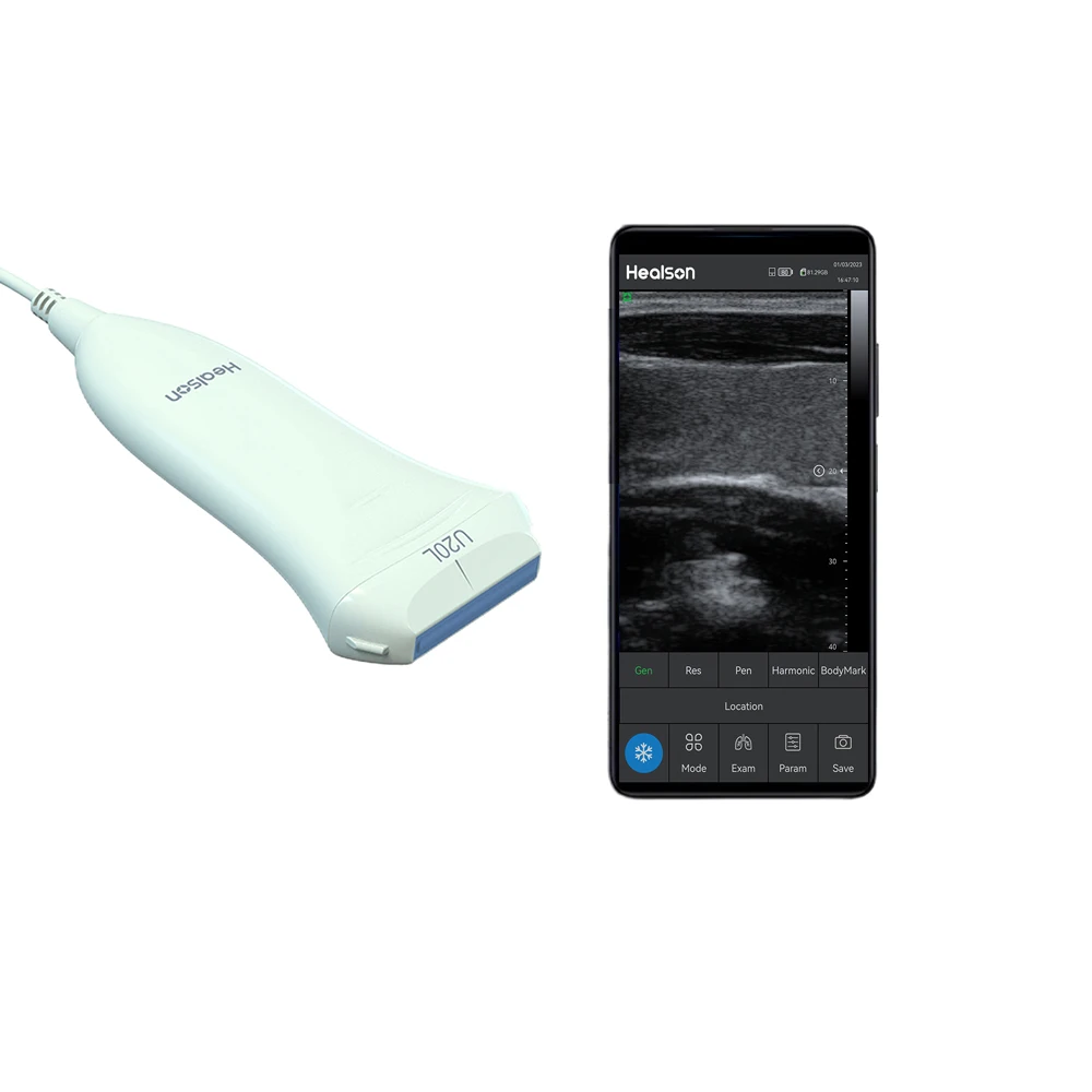 U20L USG Full Digital Mini Ultrasound Price Portable Ultrasound Machine Medical Instruments With Smartphone