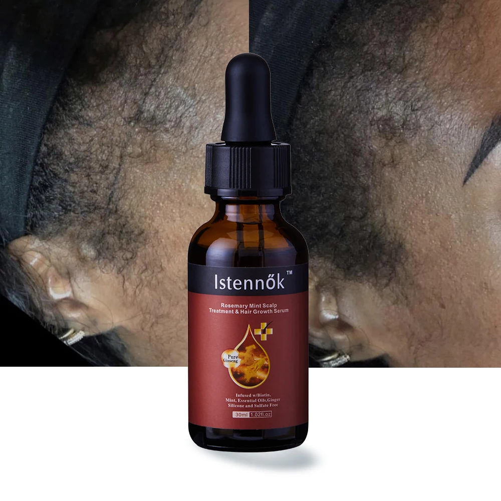 ISK Plant Extract Fast Hair Growth Oil Anti Loss Hair Oil for Hair Growth