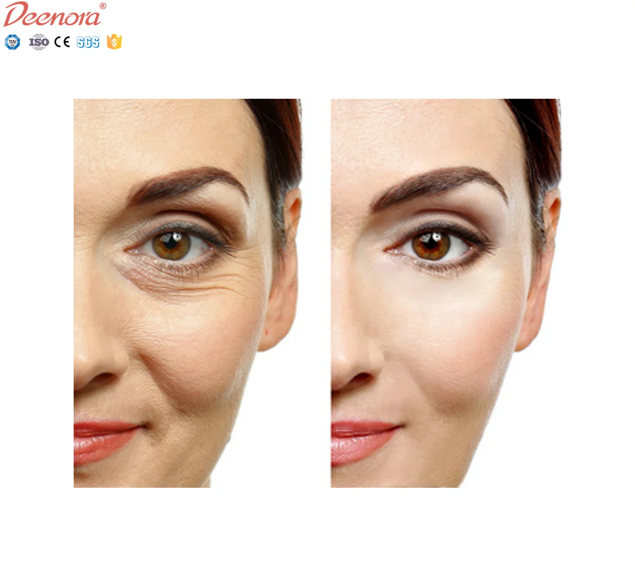 Deenora Hot Sale korean syringe cross linked injection breast  buttock enlargement knee under eye hyaluronic acid dermal filler