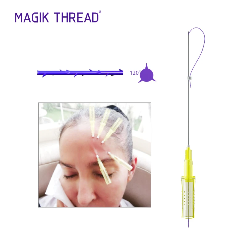 Magik Thread buy online Cog 3D L blunt 19g 100mm hilos pdo with CE approved cheap delivery