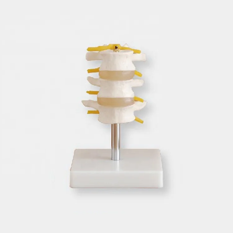 Joint model Medical education Life-Size lumbar vertebral set model human anatomical lumbar retractor set
