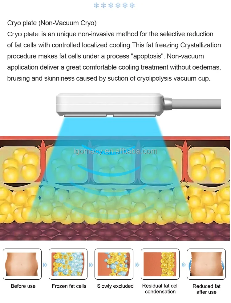6D lipo ems