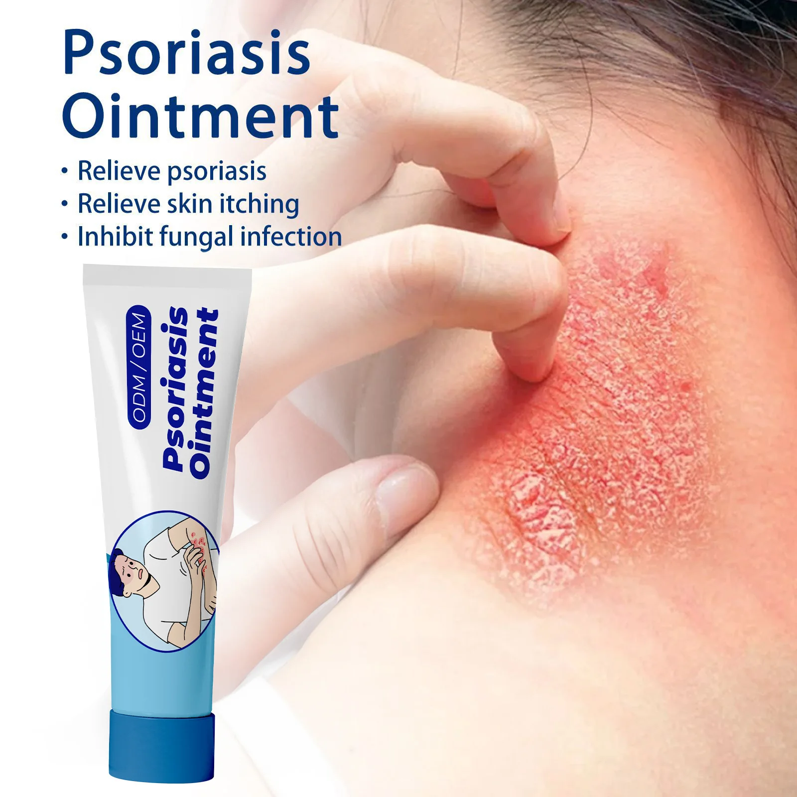 OEM Fungal eczema Chinese herbal medicine skin disease cream antipruritic psoriasis cream ointment