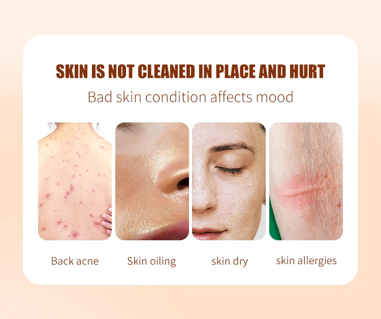 Lemon Turmeric Kojic Acid Dark Spot Remover Skin Whitening Soap Bars Set