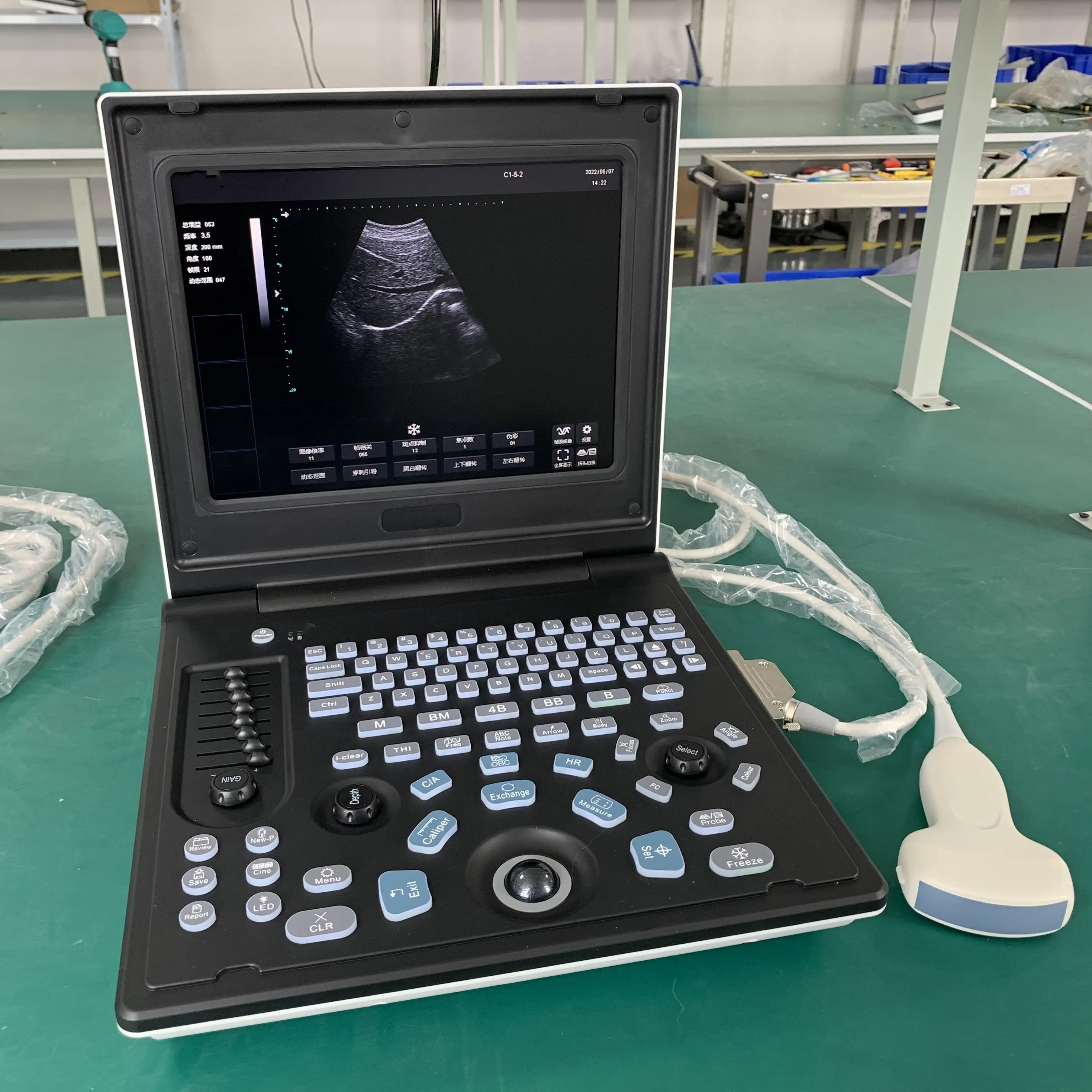 High Performance Portable Colour Full Digital CE ISO Approved Medical Diagnostic 3d Ultrasound Machine