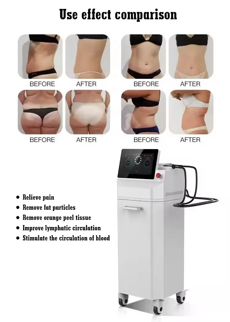 Beco Newest Cellulite Reduction massage Body sculpting  Peel Ski inner ball roller machine for home salon