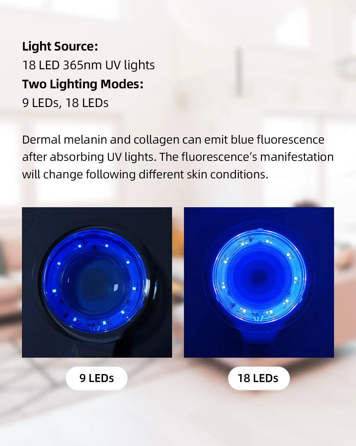 2024 Home Use Korean Animal Medical Rechargeable Detector Professional Facial Uv Magnifying Portable Woods Lamp Skin Analyzer