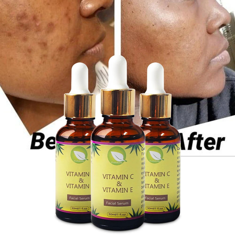 Dark Spot Removal Serum Wholesald Fast Whitening Moisturizing Face Serum Anti Wrinkle Skincare Anti Aging Serum