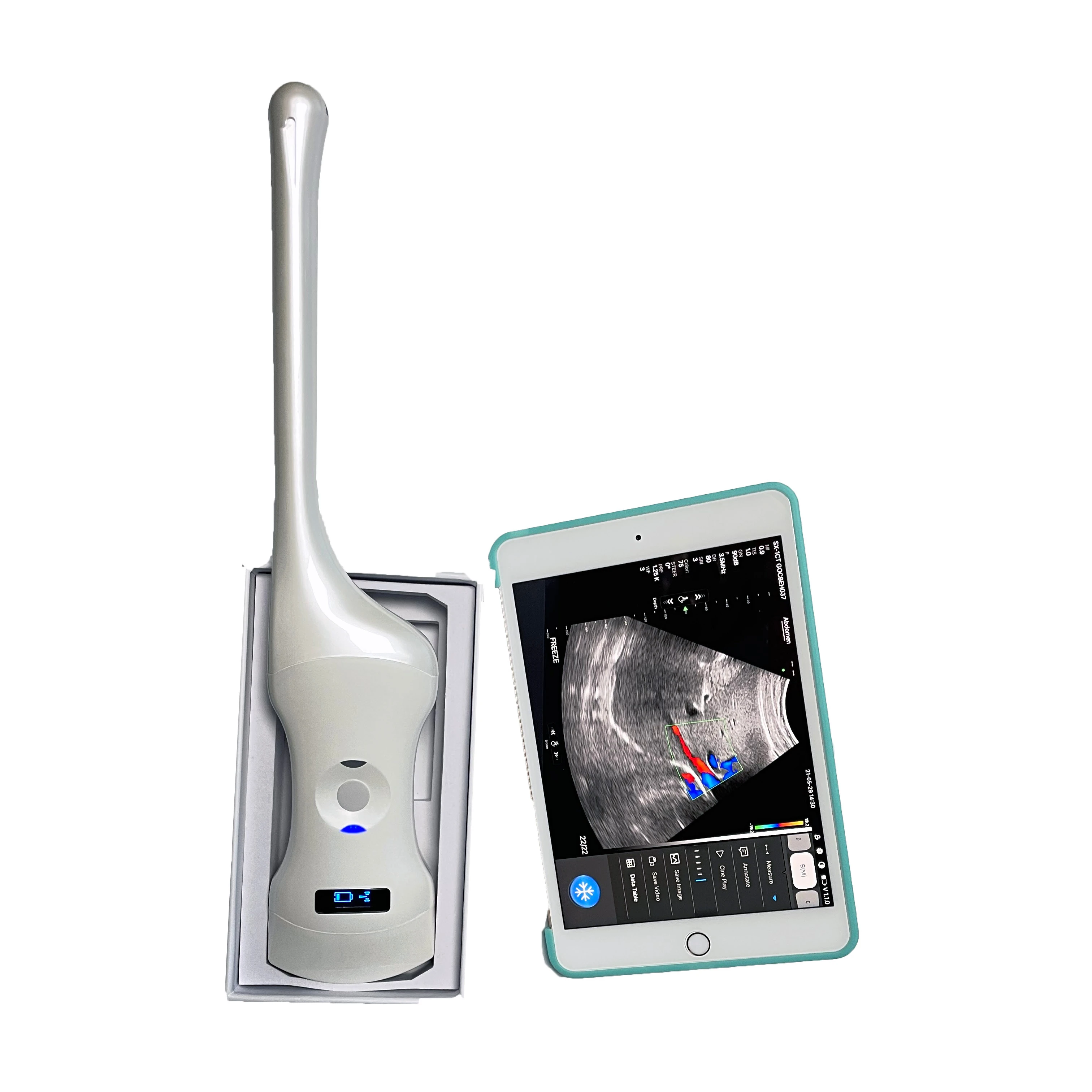 wireless double head transvaginal/convex/phased array ultrasound probe handheld medical ultrasound scanner