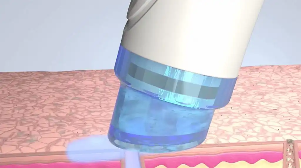 
Machine Aqua Peel Solution PS1 PS2 PS3 PSC Facial Serum Bottle set 