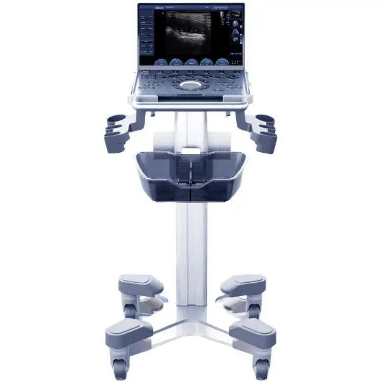 Portable Chison Ultrasound machine Sonoair 70 Ultrasound  3d 4d scanner color doppler Ultrasound System use for PT  MSK Vascular