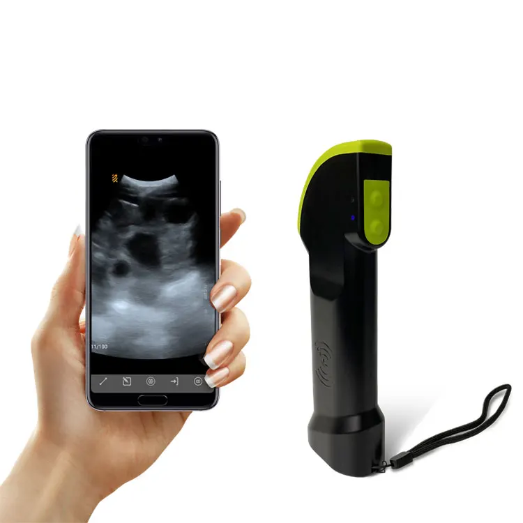 Беспроводной ультразвуковой S4 Ветеринарный аппарат зонд свинья овечка коз беременность ecografo беспроводной WIFI