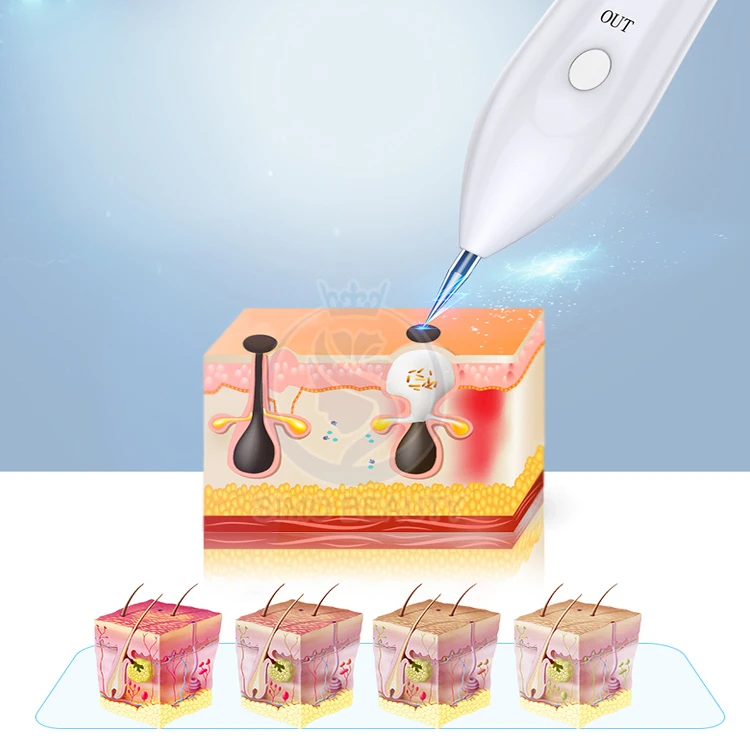 Face care lcd display mole dark spot wart removal wholesale plasma pen pins for wholesales