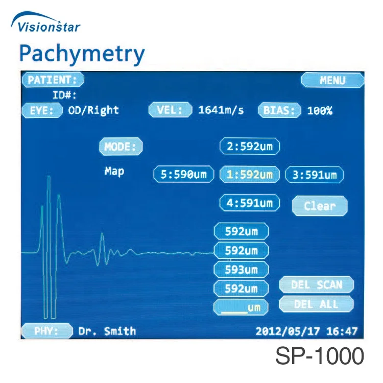 Top Quality SP-1000P Ophthalmic Ultrasonic Pachymeter