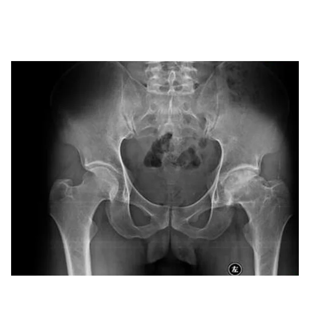 
Dry Xray bluebase films thermal imager perforated pe film for medical tape digital medical x ray dry films competitive price 